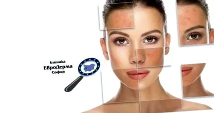 kontakt kontakt dermatitis