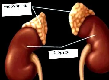 addison-kór ACTH-szinttel rendelkező