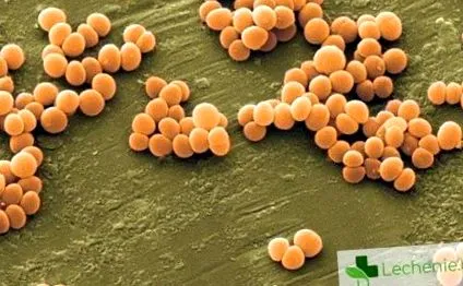 Escherichia coli külső nemi szervek