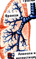 bronchopneumonia kezelése
