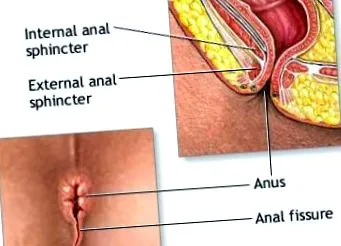 anális