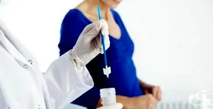 cytosmear