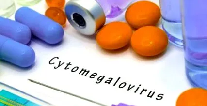 citomegalovírus diagnosztizálására