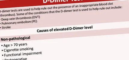 vérrögökhöz d-dimer