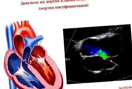 diagnosztizálása elégtelenségének