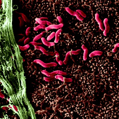 pylori