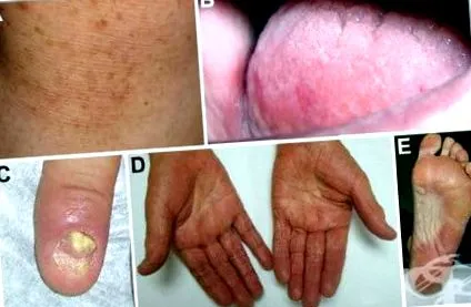 epiderma