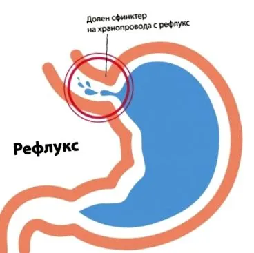 anya problémák
