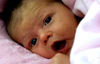 hydrocephalus hydrocephalus