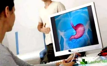 gastroduodenitis fordul