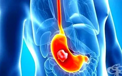 Táplálkozási tippek károsodása