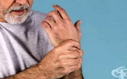 arthritisben