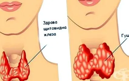 esetén Táplálkozási esetén Táplálkozási tippek