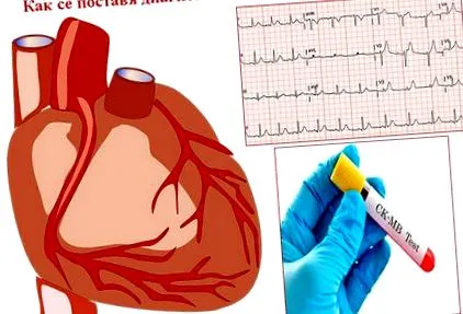 szívinfarktust diagnosztizálják