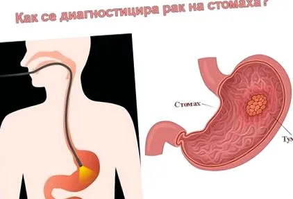hogyan diagnosztizálni