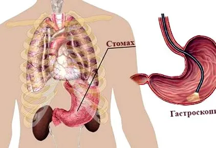 lehet diagnosztizálni