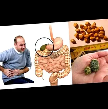 mondták epekövem