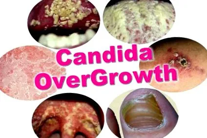 mint mint