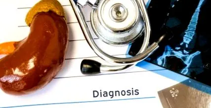 vesekövek vesekövek kialakulásához