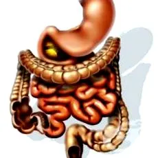 colitis táplálkozás