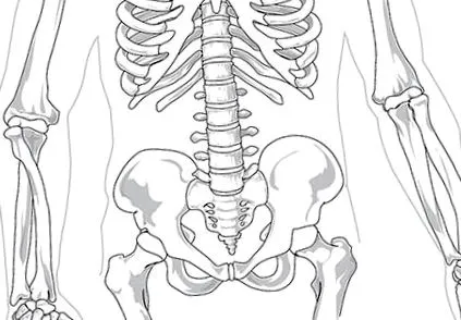 coxarthrosis coxarthrosis
