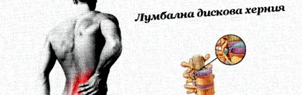 lyubomir porckorongsérv