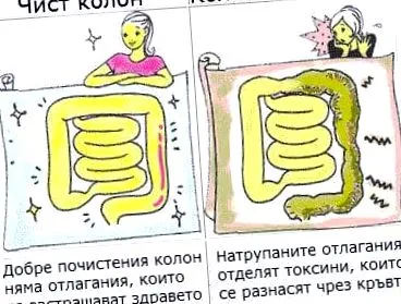 kezelésére térfogatú beöntések