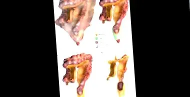 szerv mesenterium