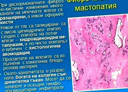 mastopathia diagnózis kezelés