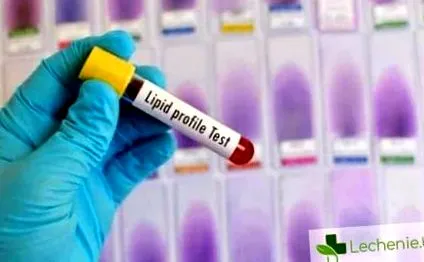 ezek lipid