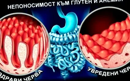 autoimmun betegség intolerancia