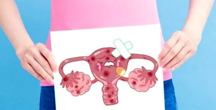 menstruációs