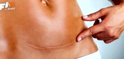 szakasz szakasz