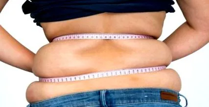 elhízás orlistat