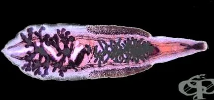 opisthorchiasis által okozott
