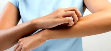 zsibbadt ekcéma zsibbadt ekcéma