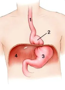 megfelelő hiatal