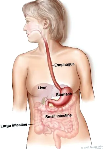 esophageal nyelőcsőrák típusa