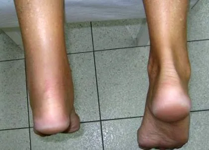kezelése