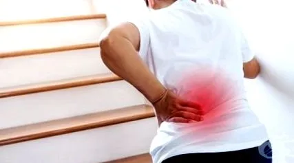 ágyéki régió radiculopathia