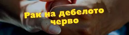 vastagbélrák tünetei
