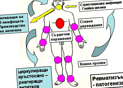reuma béta hemolitikus