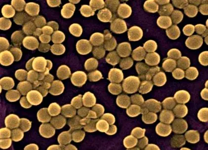 staphylococcus fertőzések