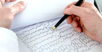 gyors tachycardia
