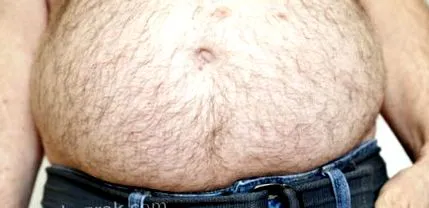 ascitesben vagy