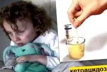 ketoacidosis nephropathia