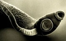 tünetek toxoplazmózis