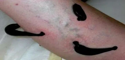 kezelés kezelés
