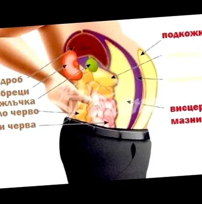 zsigeri