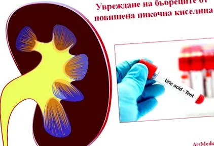 hiperurikémiás nephropathia